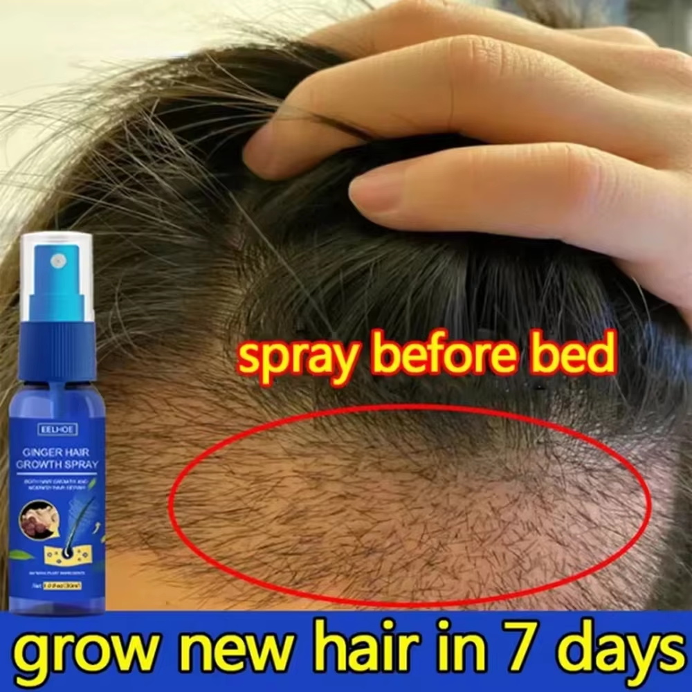 Fast Ginger Hair Growth Spray  - Hair Care Lotion recension och pris